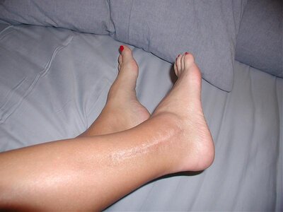 ankle-2mos 007.jpg