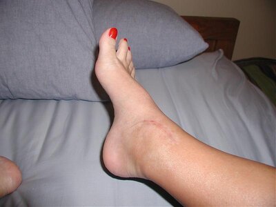 ankle-2mos 008.jpg